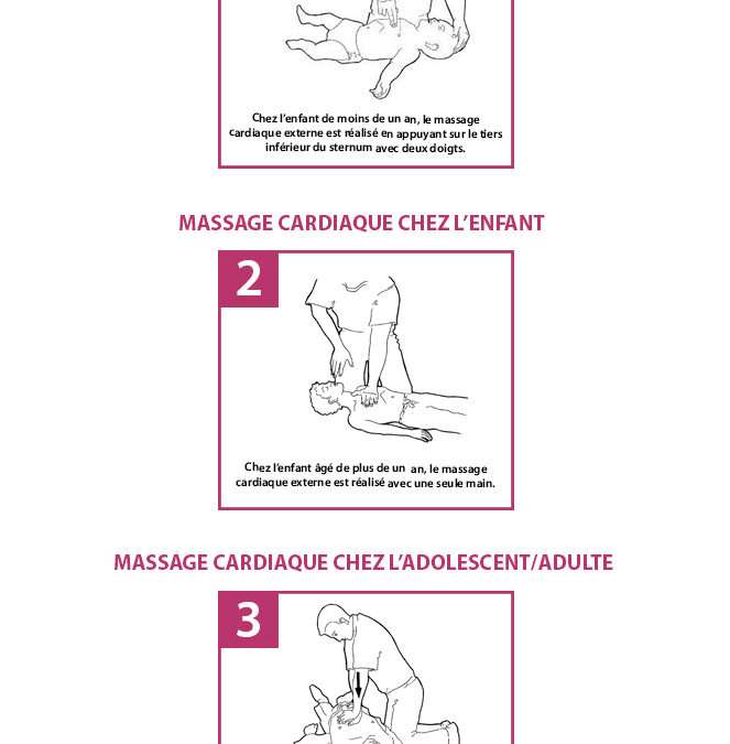 Massage cardiaque sur le nourrisson et l’enfant